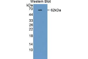 Western blot analysis of recombinant Human IK. (Protein Red (IK) (AA 1-192) Antikörper)