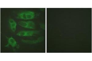 Immunofluorescence (IF) image for anti-Adrenergic, beta-2-, Receptor, Surface (ADRB2) (AA 321-370) antibody (ABIN2888906) (beta 2 Adrenergic Receptor Antikörper  (AA 321-370))
