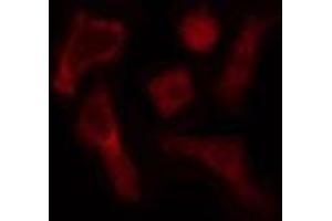 ABIN6275179 staining  HepG2 cells by IF/ICC. (GNB5 Antikörper  (Internal Region))