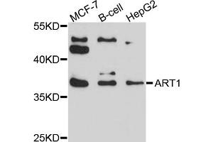 Western blot analysis of extracts of various cell lines, using ART1 antibody (ABIN6003801) at 1/1000 dilution.