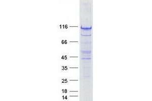 STRIP1 Protein (Myc-DYKDDDDK Tag)