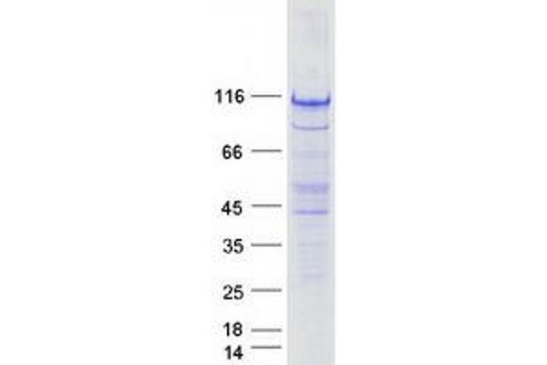 STRIP1 Protein (Myc-DYKDDDDK Tag)