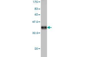 Western Blotting (WB) image for anti-Pro-Platelet Basic Protein (Chemokine (C-X-C Motif) Ligand 7) (PPBP) (AA 37-128) antibody (ABIN562336)