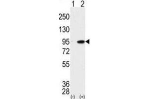 Western Blotting (WB) image for anti-Male Germ Cell-Associated Kinase (MAK) antibody (ABIN3003276)