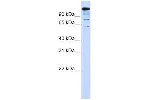 Western Blotting (WB) image for anti-BTB and CNC Homology 1, Basic Leucine Zipper Transcription Factor 2 (BACH2) (Middle Region) antibody (ABIN2781161)