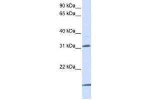 Western Blotting (WB) image for anti-Solute Carrier Family 25 (Mitochondrial Carrier, Oxoglutarate Carrier), Member 11 (SLC25A11) antibody (ABIN2458782) (SLC25A11 Antikörper)