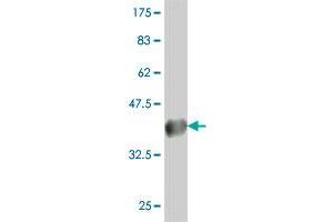 Western Blotting (WB) image for anti-Chloride Channel, Voltage-Sensitive 7 (CLCN7) (AA 706-805) antibody (ABIN560399)