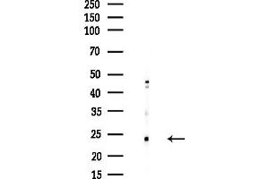 anti-Ribosomal Protein L28 (RPL28) antibody