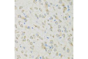 Immunohistochemistry of paraffin-embedded mouse brain using CLCN7 antibody (ABIN5974147) at dilution of 1/100 (40x lens).