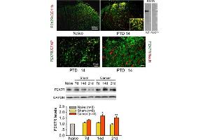 Expression and upregulation of microglial P2X7 receptor in cancer.