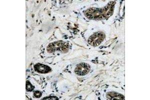 Immunohistochemical analysis of Beta-tubulin staining in human colon formalin fixed paraffin embedded tissue section. (TUBB Antikörper)