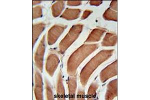 SIKE Antibody immunohistochemistry analysis in formalin fixed and paraffin embedded human skeletal muscle followed by peroxidase conjugation of the secondary antibody and DAB staining. (SIKE1 Antikörper  (C-Term))