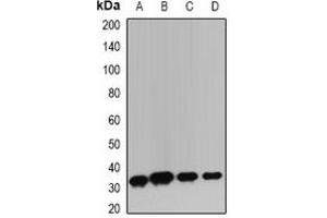 Western blot analysis of TIM3 expression in HepG2 (A), BT474 (B), mouse lung (C), mouse thymus (D) whole cell lysates. (TIM3 Antikörper)
