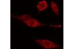 ABIN6275681 staining  HuvEc cells by IF/ICC.
