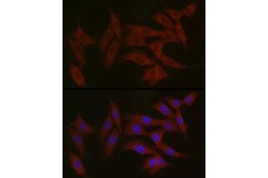 Immunofluorescence (IF) image for anti-Tyrosine Kinase 2 (TYK2) (AA 750-850) antibody (ABIN3022988)