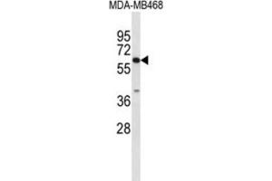 Western Blotting (WB) image for anti-Carboxylesterase 5A (CES5A) antibody (ABIN3004057) (CES5A Antikörper)