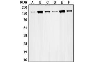 Western blot analysis of RAD50 expression in HeLa (A), K562 (B), Jurkat (C), MCF7 (D), Ramos (E), SW480 (F) whole cell lysates. (RAD50 Antikörper  (Center))