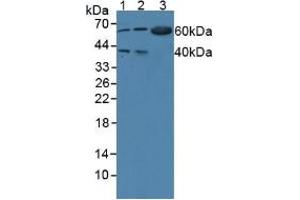Western blot analysis of (1) Human 293T Cells, (2) Human BXPC-3 Cells and (3) Mouse Pancreas Tissue. (WARS Antikörper  (AA 247-458))