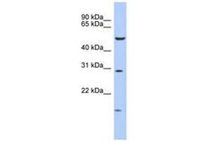 Image no. 1 for anti-Homeobox C5 (HOXC5) (AA 143-192) antibody (ABIN6742202)
