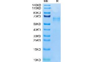 Human LTK on Tris-Bis PAGE under reduced condition. (LTK Protein (AA 17-424) (His tag))