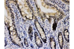 IHC analysis of CRY1 using anti-CRY1 antibody (ABIN3042761). (CRY1 Antikörper  (N-Term))