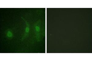 Immunofluorescence analysis of HeLa cells, using IRF-3 (Phospho-Ser385) antibody. (IRF3 Antikörper  (pSer385))