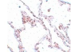 Immunohistochemical staining of human lung tissue with TMEM184B polyclonal antibody  at 5 ug/mL dilution. (TMEM184B Antikörper  (C-Term))