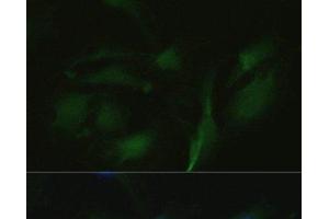 Immunofluorescence analysis of U2OS cells using TRPV1 Polyclonal Antibody at dilution of 1:100. (TRPV1 Antikörper)