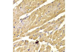 Immunohistochemistry of paraffin-embedded rat heart using PEX5 antibody (ABIN5973402) at dilution of 1/100 (40x lens). (PEX5 Antikörper)
