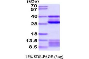 Cathepsin S Protein (CTSS) (AA 24-340) (His tag)