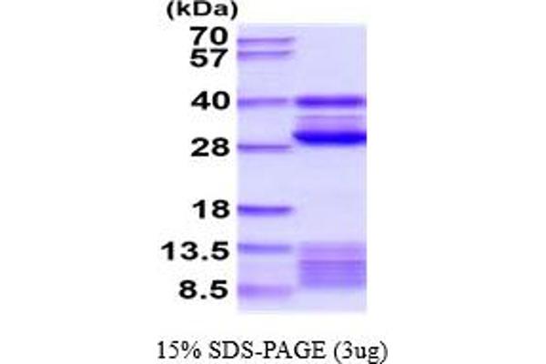 Cathepsin S Protein (CTSS) (AA 24-340) (His tag)