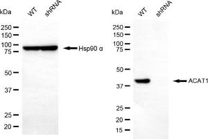Western blotting analysis using ACAT1 antibody (ABIN7797438). (ACAT1 Antikörper)