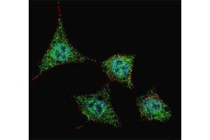 Fluorescent confocal image of HeLa cells stained with phospho-Bad antibody at 1:200. (BAD Antikörper  (pSer99))