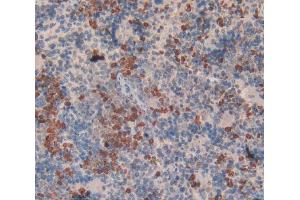Immunohistochemistry (IHC) image for anti-Low Density Lipoprotein Receptor (LDLR) (AA 335-588) antibody (ABIN5013888)