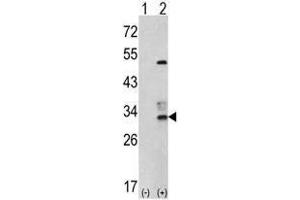 Image no. 1 for anti-Capping Protein (Actin Filament) Muscle Z-Line, beta (CAPZB) (N-Term) antibody (ABIN452809) (CAPZB Antikörper  (N-Term))