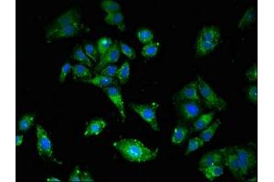 Immunofluorescent analysis of HepG2 cells using ABIN7158563 at dilution of 1:100 and Alexa Fluor 488-congugated AffiniPure Goat Anti-Rabbit IgG(H+L) (LDLR Antikörper  (AA 49-244))