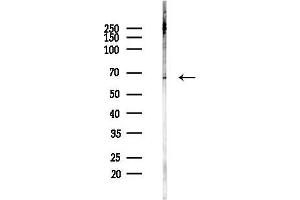 Western blot analysis of lysates from Rat brain, using CTPS Antibody at 1/1000 dilution.