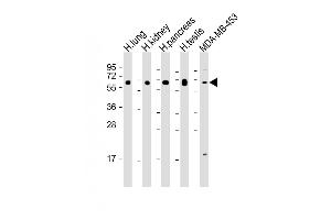 Western Blotting (WB) image for anti-HERV-H LTR-Associating 2 (HHLA2) (AA 58-87) antibody (ABIN654607)