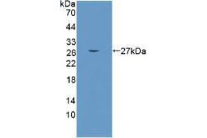 Western blot analysis of the recombinant protein. (CRAT Antikörper  (AA 55-256))