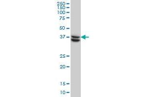 SUGT1 monoclonal antibody (M03), clone 6G5 Western Blot analysis of SUGT1 expression in HeLa .