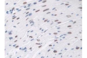 Immunohistochemistry (IHC) image for anti-Transaldolase 1 (TALDO1) (AA 35-285) antibody (ABIN7440293)