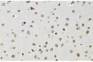 Immunohistochemistry of paraffin-embedded Rat brain using TMPO Polyclonal Antibody at dilution of 1:100 (40x lens). (Thymopoietin Antikörper)