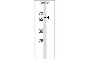 SNX18 Antibody (C-term) (ABIN1537397 and ABIN2848961) western blot analysis in WiDr cell line lysates (35 μg/lane).