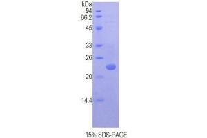 SDS-PAGE (SDS) image for Chromobox Homolog 3 (CBX3) (AA 1-183) protein (His tag) (ABIN2120807) (CBX3 Protein (AA 1-183) (His tag))