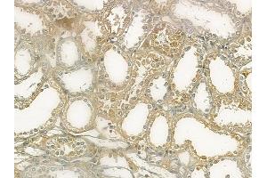 ABIN6265206 and ABIN6273074 at 1/100 staining human normal kidney tissue by IHC-P. (SNAPIN Antikörper  (N-Term))
