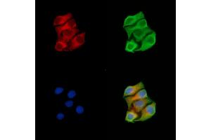 ABIN7094876 and ABIN7098928 staining Hela cells by IF/ICC. (MUT Antikörper  (N-Term))