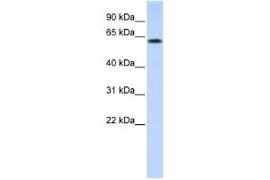 TRIM55 antibody used at 1 ug/ml to detect target protein. (TRIM55 Antikörper  (N-Term))