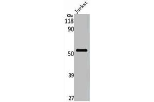 Western Blot analysis of Jurkat cells using PFK-2 liv Polyclonal Antibody (PFKFB1 Antikörper  (C-Term))