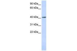 Image no. 1 for anti-SET and MYND Domain Containing 3 (SMYD3) (AA 36-85) antibody (ABIN6741089)
