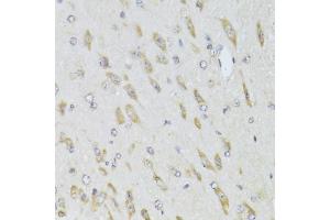 Immunohistochemistry of paraffin-embedded mouse brain using RPL13 Antibody (ABIN2559760) at dilution of 1:100 (40x lens). (RPL13 Antikörper)